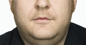 double chin exercises double chin exercises