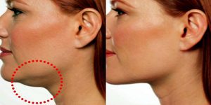 double chin exercises double chin exercises