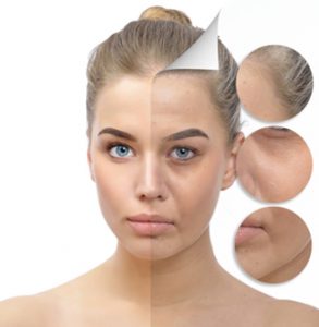 Fat Transfer surgery islamabad