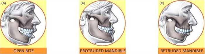 Jaw Surgery in Islamabad