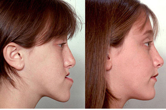 Jaw Surgery in Pakistan