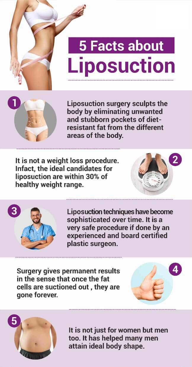 Liponew Liposuction in Islamabad