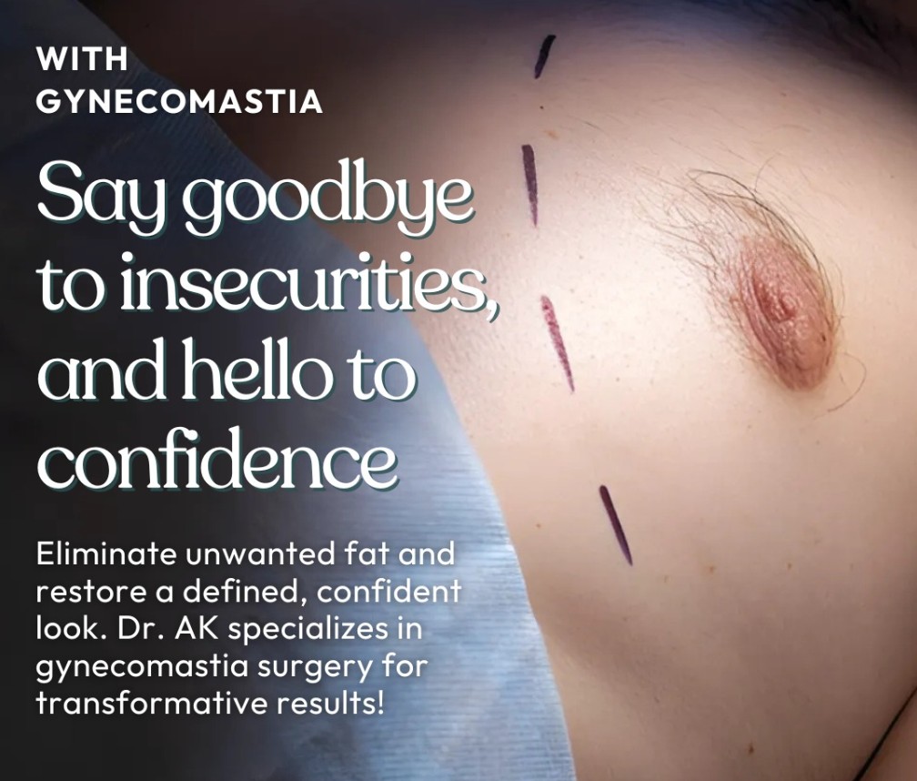 Gynecomastia cosmetic surgery in Islamabad F-8 Markaz by Prof Dr Abdul Khaliq