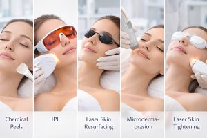 Skin Rejuvenation Treatments Available in Islamabad