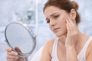 Who Should Consider Microdermabrasion